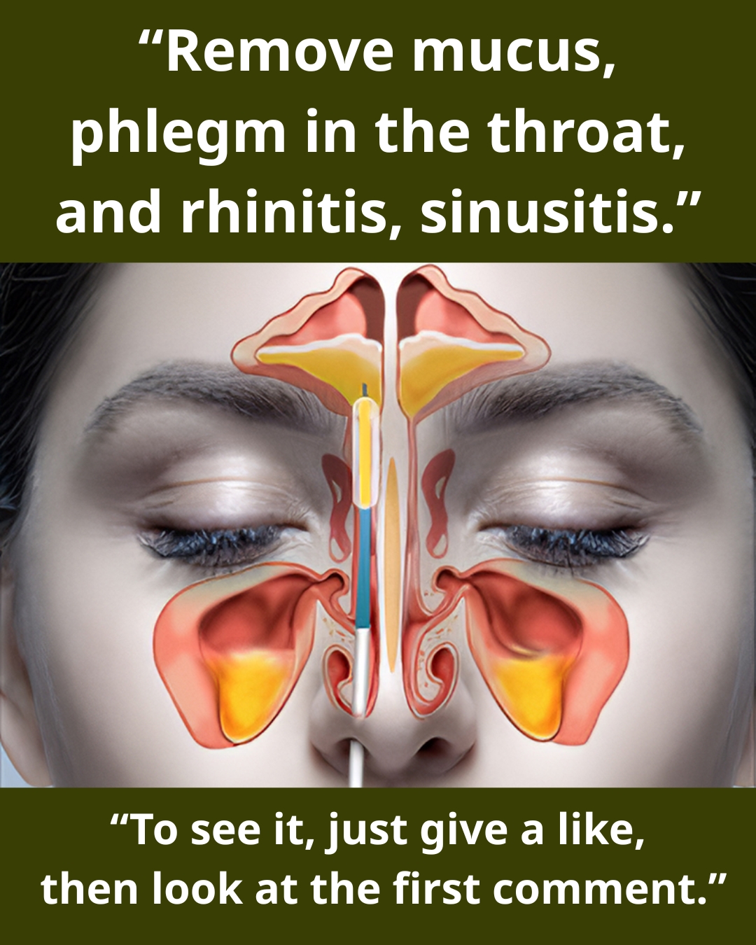 Clear Mucus, Phlegm, and Nasal Congestion Fast: Effective Home Remedies ...